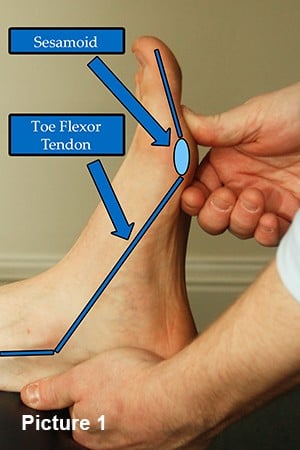 Toe joint for surface anatomy