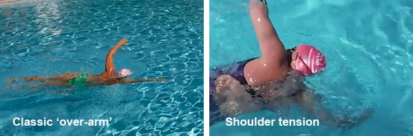 Classic 'over-arm' and shoulder tension