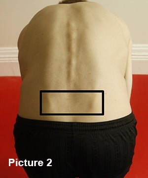 Posterior view of pelvis bending 